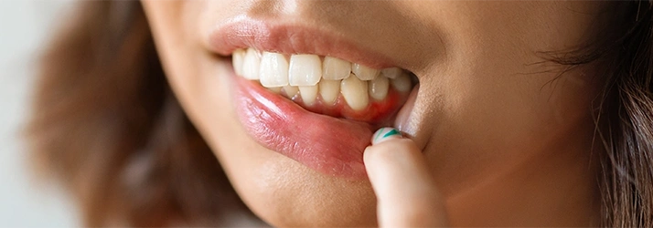 Abscessed Teeth Specialist